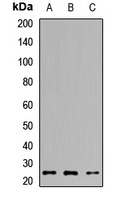 TPPP Antibody