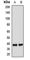 FBXO2 Antibody