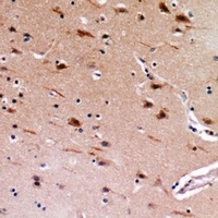 Anti-MEMO1 Antibody