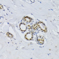 Anti-BCCIP Antibody