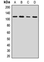 FAAP100 Rabbit Polyclonal Antibody