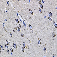 Anti-TMC1 Antibody