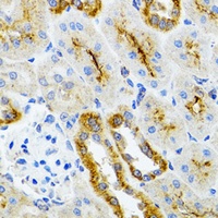 Anti-AIFM3 Antibody