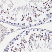 Anti-HFM1 Antibody