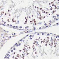 HFM1 antibody