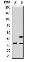 KCNK9 Rabbit Polyclonal Antibody