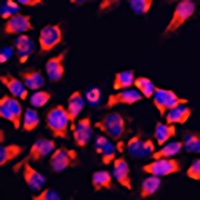Anti-ALDH7A1 Antibody