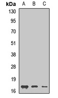 GMF beta Rabbit Polyclonal Antibody