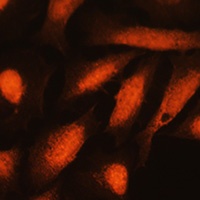 Anti-GMF beta Antibody