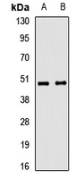 TRIM44 Rabbit Polyclonal Antibody