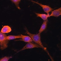 Anti-CACYBP Antibody