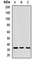 RPIA Antibody