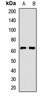 Tricellulin Rabbit Polyclonal Antibody