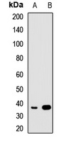CRALBP Rabbit Polyclonal Antibody