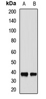 MED4 Rabbit Polyclonal Antibody
