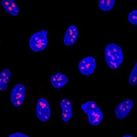 EBNA1BP2 antibody