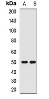 SQRDL Rabbit Polyclonal Antibody