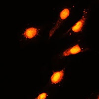 Anti-GTF3C4 Antibody