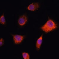 Anti-NUMB Antibody