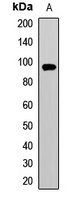 PYGM Rabbit Polyclonal Antibody