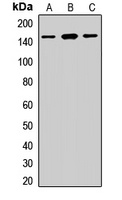 Desmoglein 2 Rabbit Polyclonal Antibody
