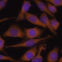 Anti-Ubiquilin 2 Antibody