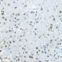 GATAD2B Rabbit Polyclonal Antibody