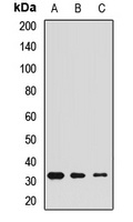 Calretinin Antibody