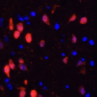 Anti-Calretinin Antibody