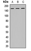 EPS15 Rabbit Polyclonal Antibody