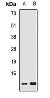 FDX1 Antibody