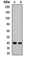 HOXA13 Rabbit Polyclonal Antibody