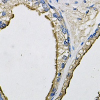 Anti-LCN1 Antibody