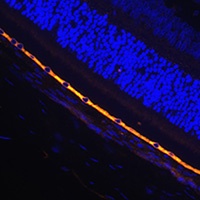 RPE65 antibody