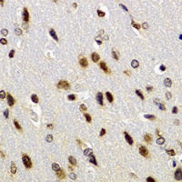 Anti-BAZ1B Antibody