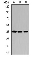 AIP Rabbit Polyclonal Antibody
