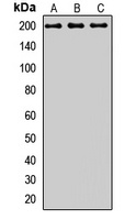 CD280 Rabbit Polyclonal Antibody