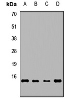 MRPS16 Rabbit Polyclonal Antibody