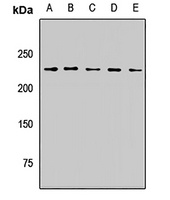 PB1 Rabbit Polyclonal Antibody