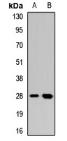 Dectin 1 Rabbit Polyclonal Antibody