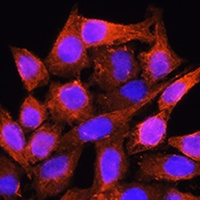 Anti-AMT Antibody