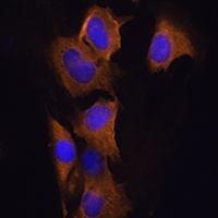 Anti-ATP1B2 Antibody