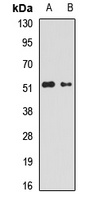 GABRA5 Rabbit Polyclonal Antibody