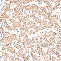 KIR3DS1 Rabbit Polyclonal Antibody