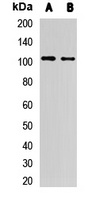 MetRS Rabbit Polyclonal Antibody