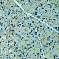 Anti-Alpha-2-antiplasmin Antibody