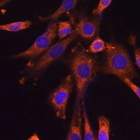 Anti-SUV3 Antibody