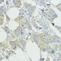 Anti-SOCS6 Antibody
