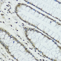 Anti-TRIP12 Antibody