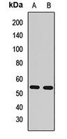 RGS14 Rabbit Polyclonal Antibody